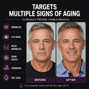 targets wrinkles eye bags, neck wrinkles, dark spots, firmness, dry skin