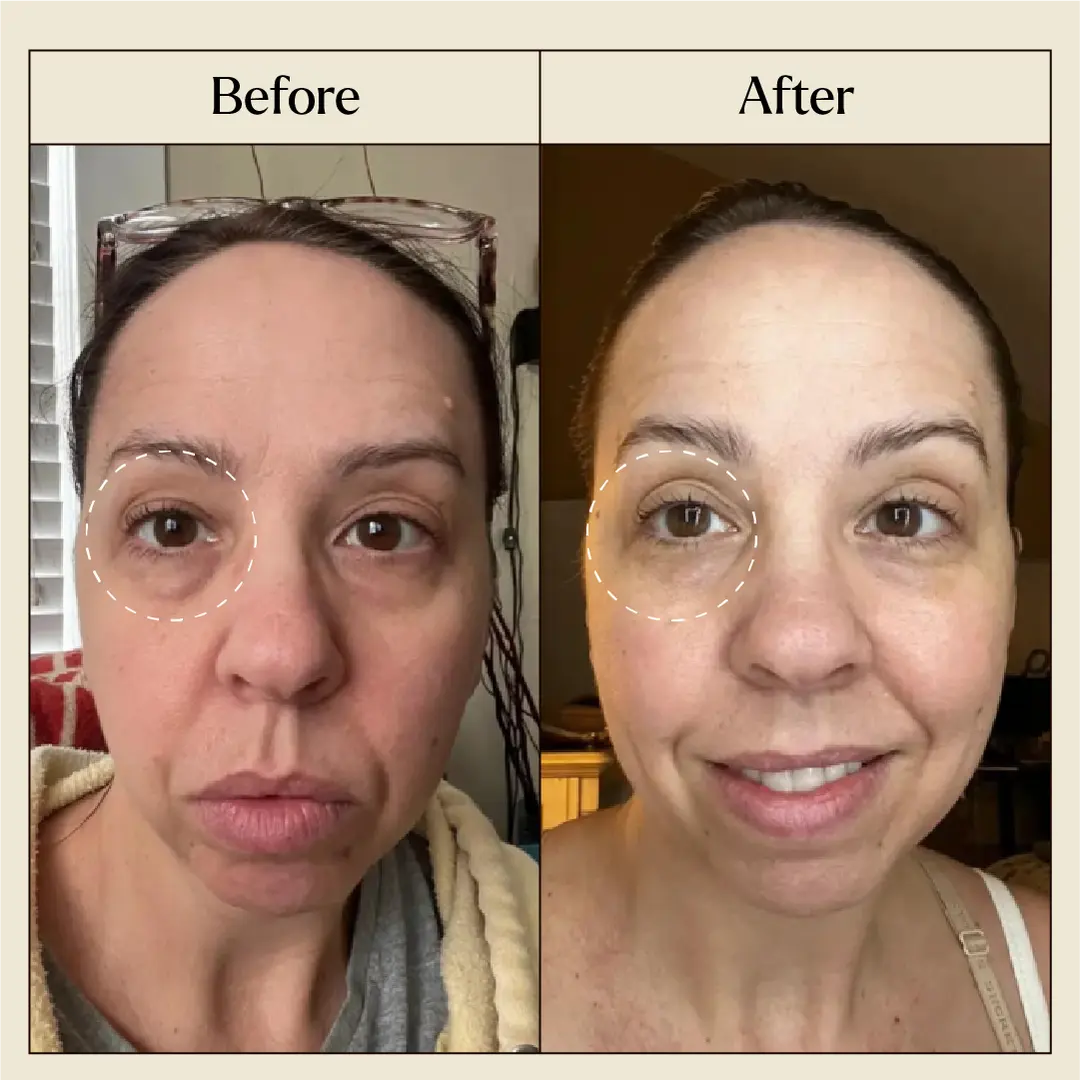 Before/after