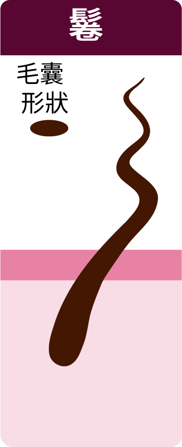 elliptical follicle -curly