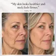before after picture of customer with review-'this really helped with my eye bags and over skin."