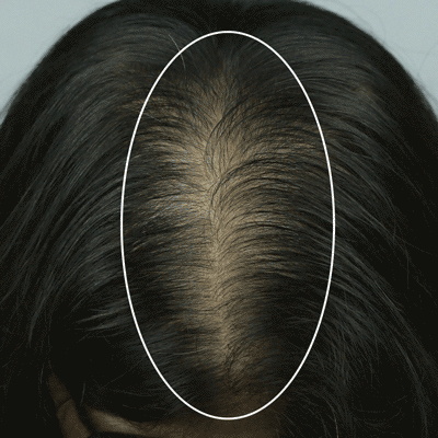 Week 0 – Hair top view