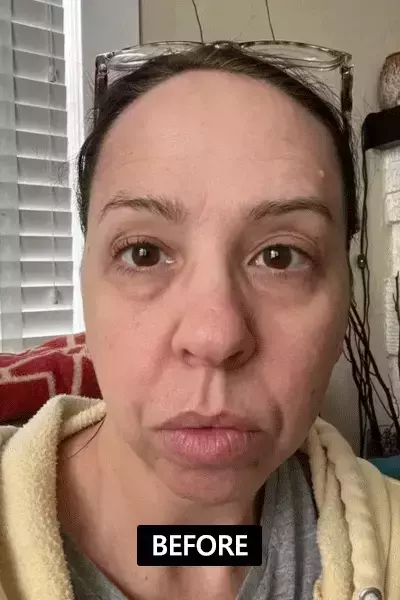 Before After GIF - Review 2