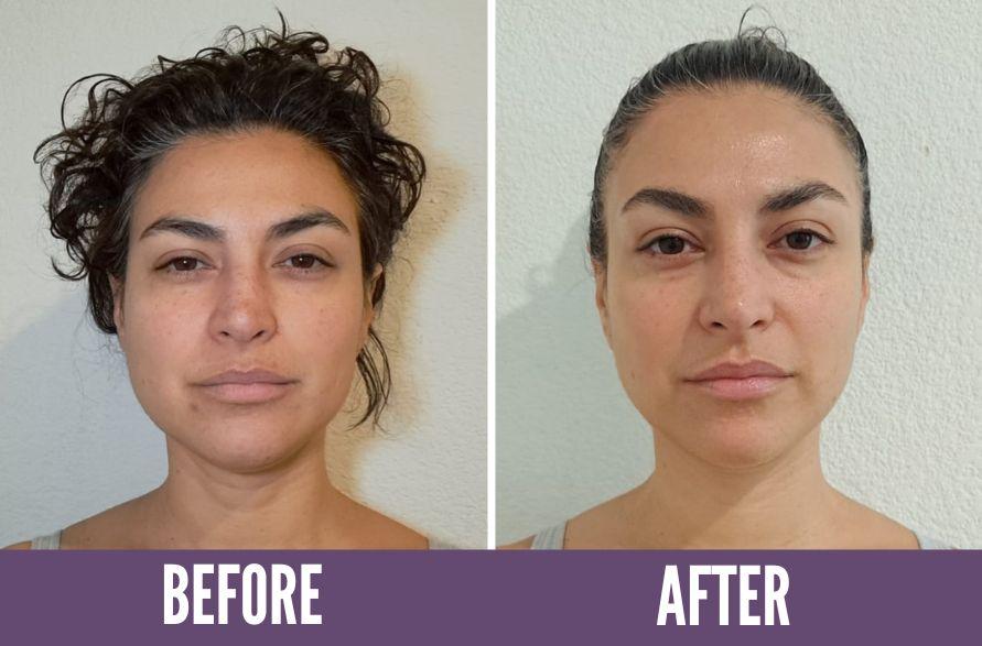 Koko Face Yoga Before/After Results