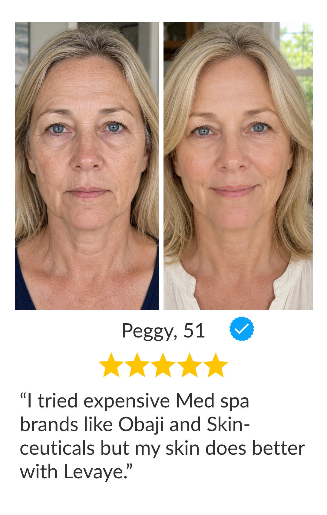 before after image showing long full lashes