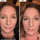 Before - After using the product