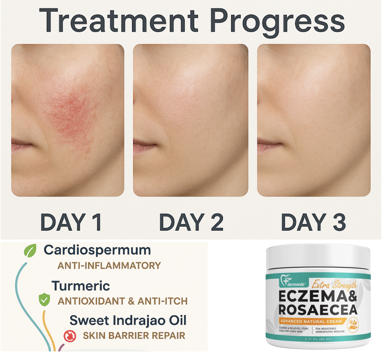 Before and After Treatment progress with Dermveda Eczema cream
