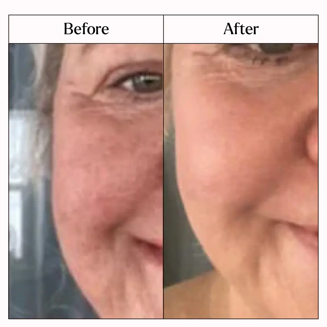 Before and after image of a consumer using the product