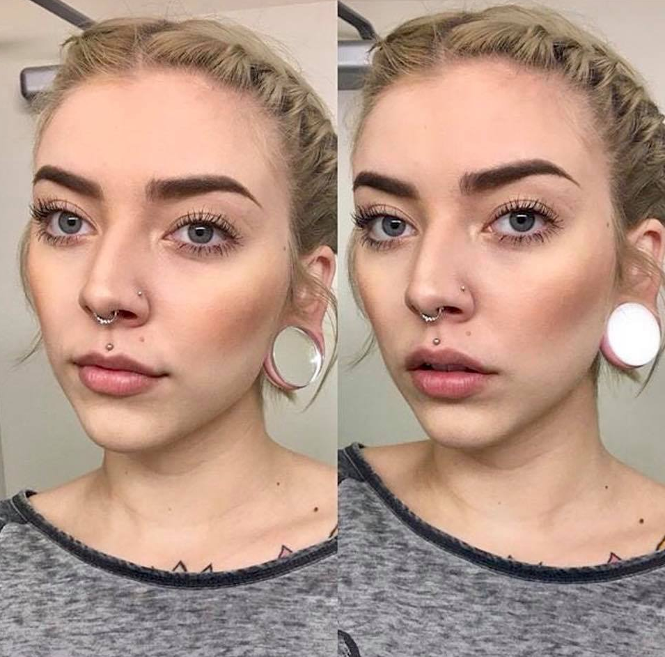 medusa piercing