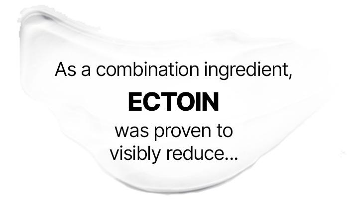 ECTOIN was proven to visibly reduce