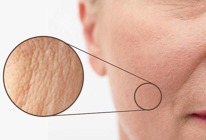 So, thirstiest of thirsty skin? Or above-30 skin? Poreslay with its top-notch porcelain-skin game is in!