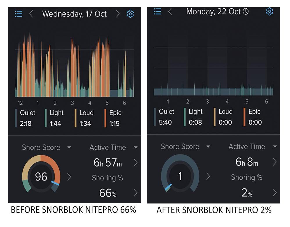 Snorelab Code Snorblok NitePro