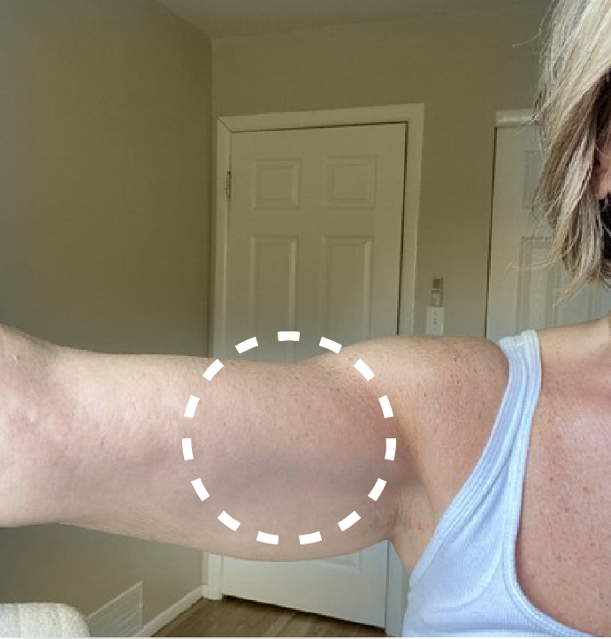 Dry arms
