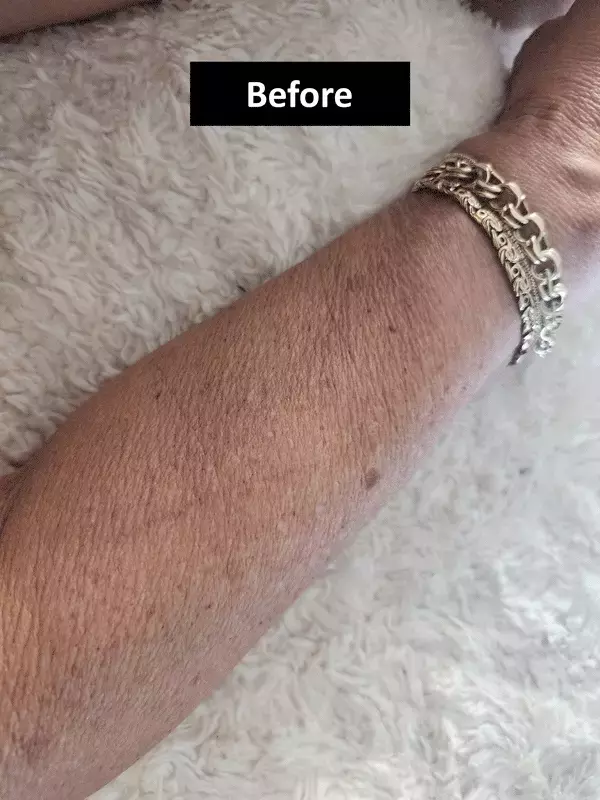 Before image of customer 1