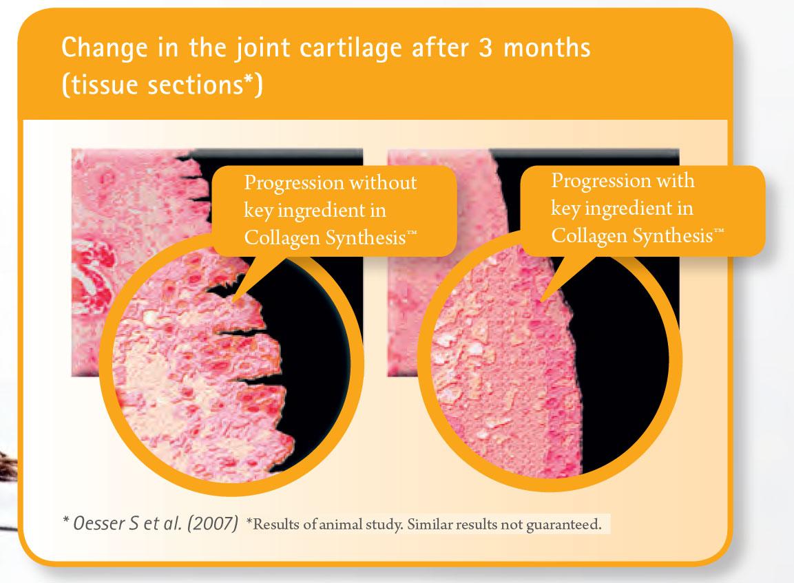 Collagen Synthesis cartilage repair image
