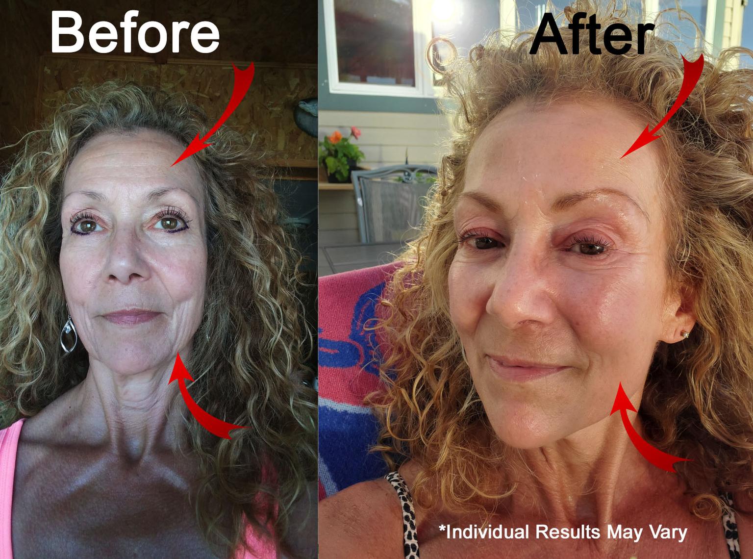 Super C Serum Vibriance