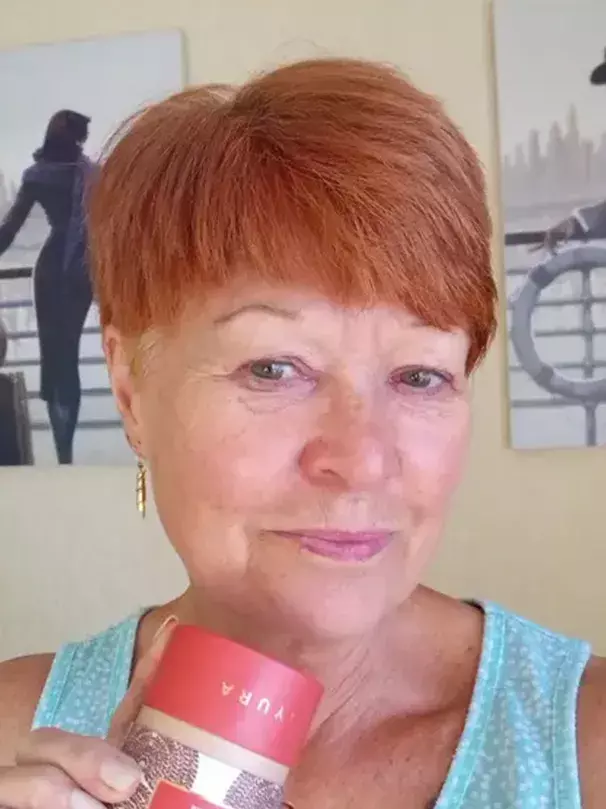 After image of customer 3