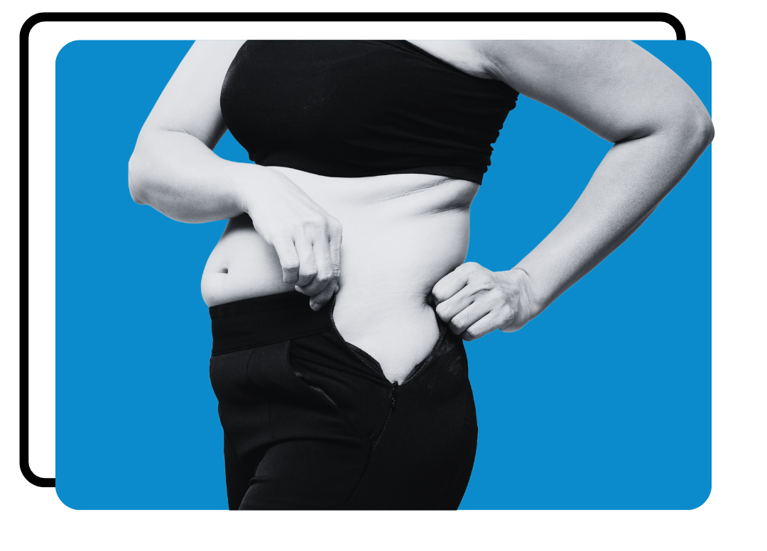 Woman pinching excess fat on her waistline.