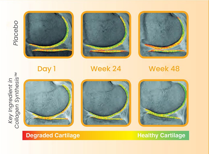 Collagen Synthesis cartilage repair image