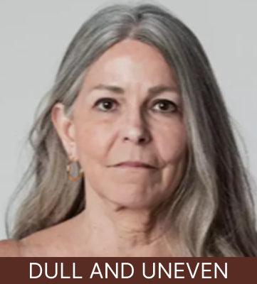 Dull and Uneven Skin - Tablet