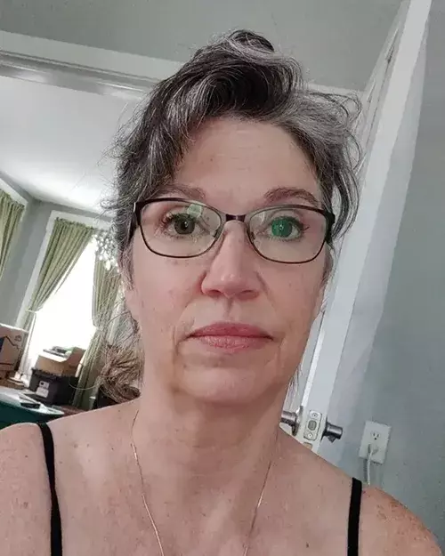 Before image of customer 4