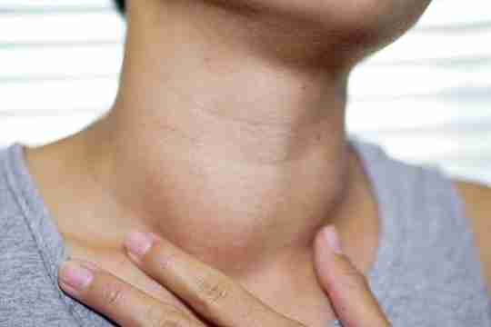 Thyroid Gland Person Gray Shirt Grabbing At Neck