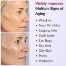 Strateva RX all in one anti aging serum targets wrinkles, dark spots, dark circles, fine lines, eye bags
