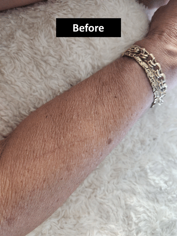 Before After GIF - Review 1