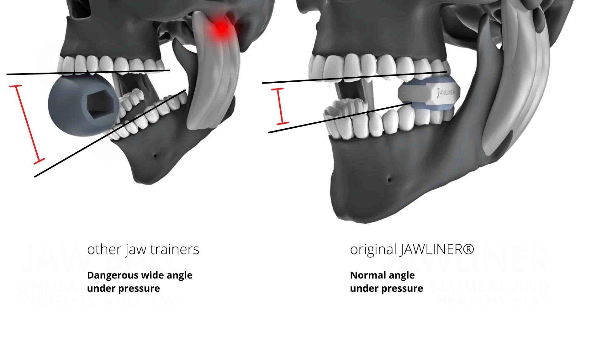 How To Grow Your Jaw Muscles Without Surgery how-to-grow-your-jaw-muscles-without-surgery