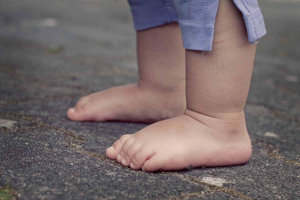 Why Do Babies Have Smelly Feet?