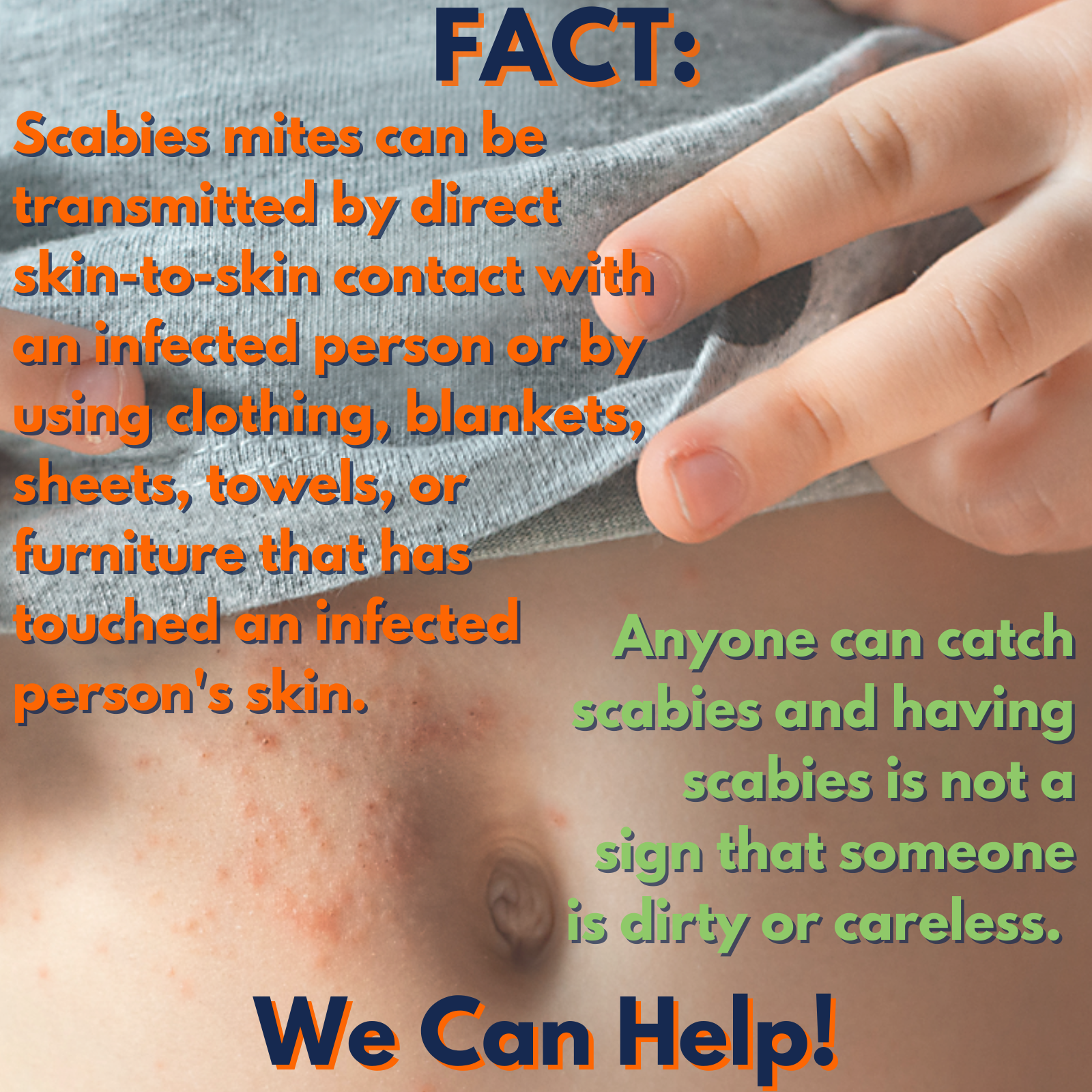scabies fact