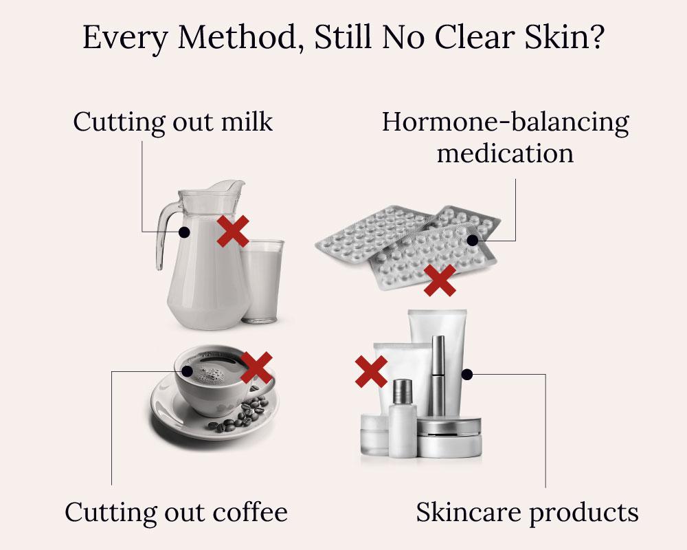 Unsuccessful methods to deal with acne