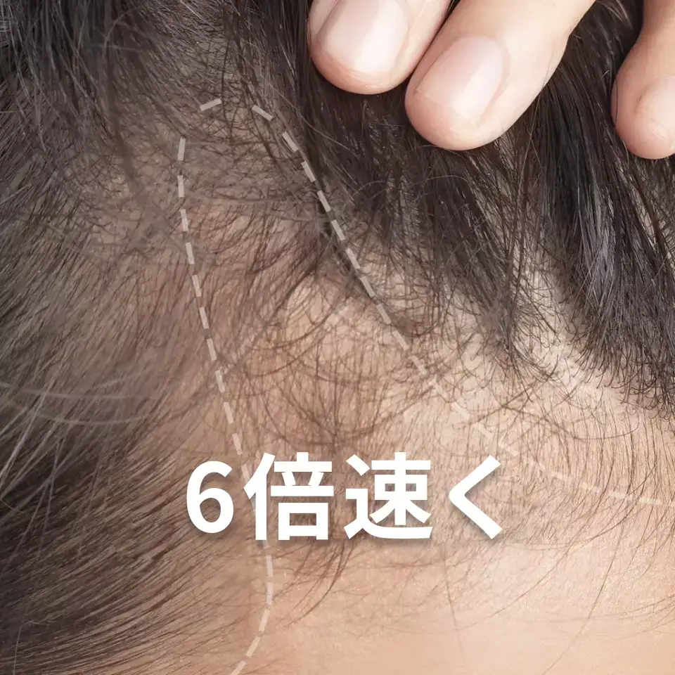 Scalp aging