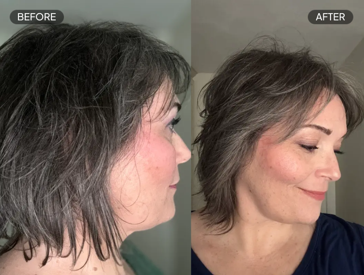 Lisa S - Before & After Review