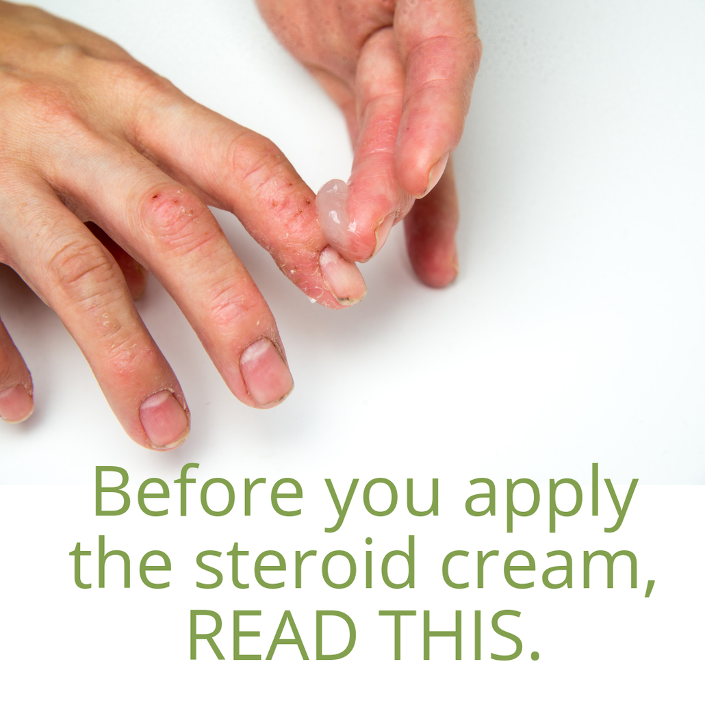 steroids and eczema - what's the best treatment route