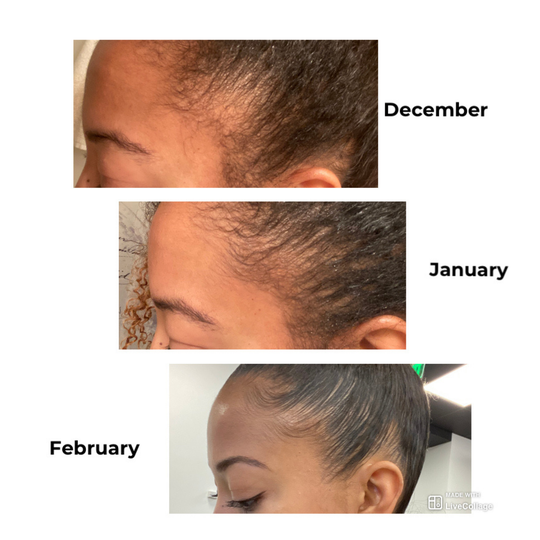 tree naturals hair growth oil results