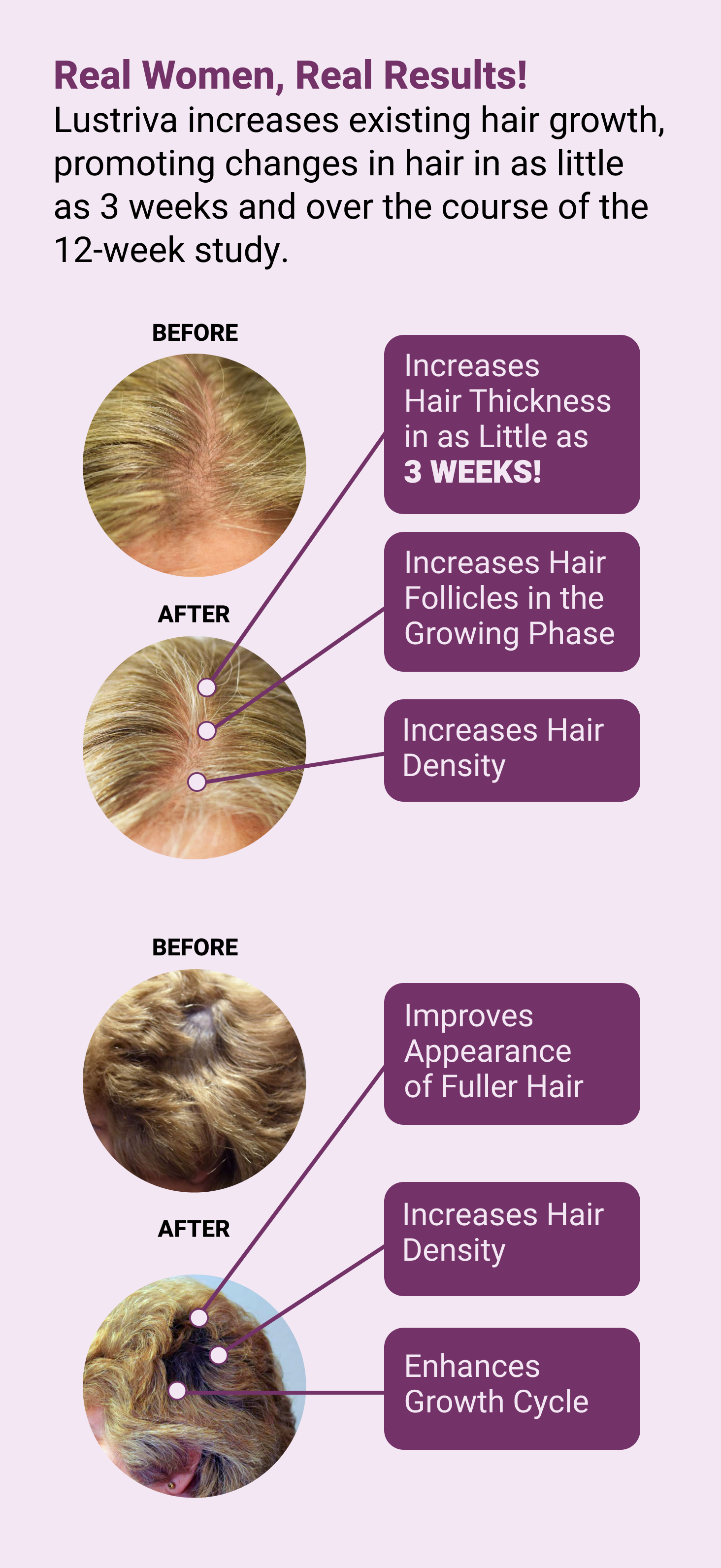 before and after photos of subject results from the study using lustriva