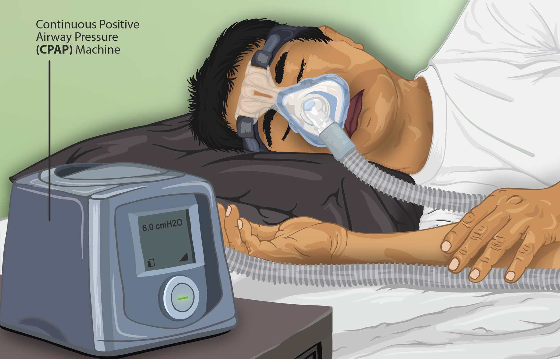 Find out how you can buy CPAP supplies online effortlessly