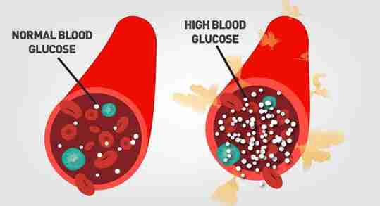 Blood Vessels Blood Cells Blood Glucose Normal High