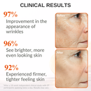 Levaye vitamin c serum clinical results 95% saw visible wrinkle improvement