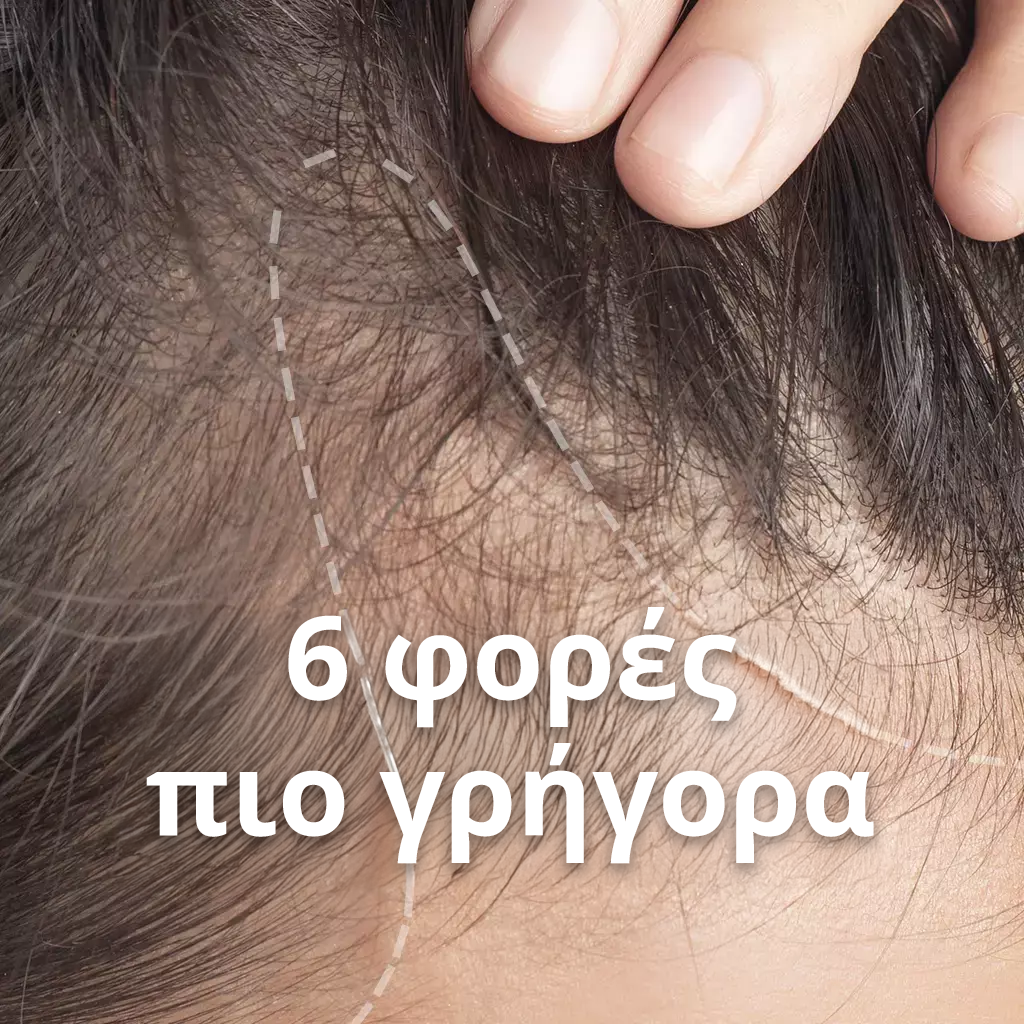 Scalp aging