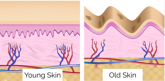 comparison between young and old skin