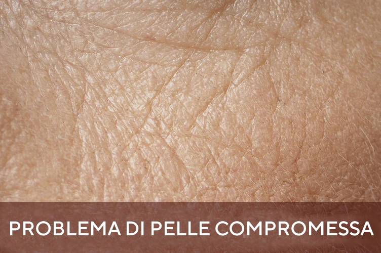Impaired Skin Barrier - Mobile