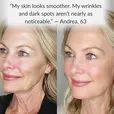Levaye vitamin c serum before after image