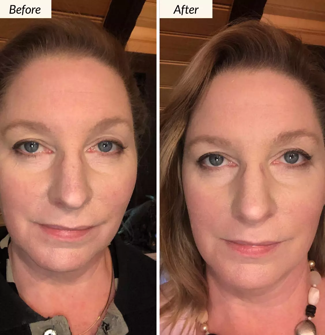 Before and After using Kesaradi Oil