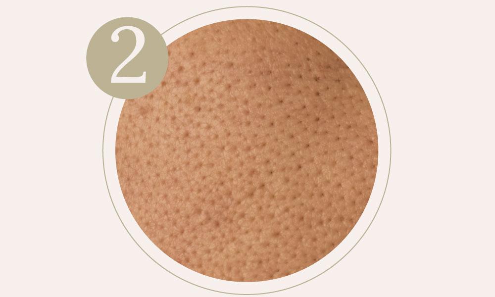 Clogged pores