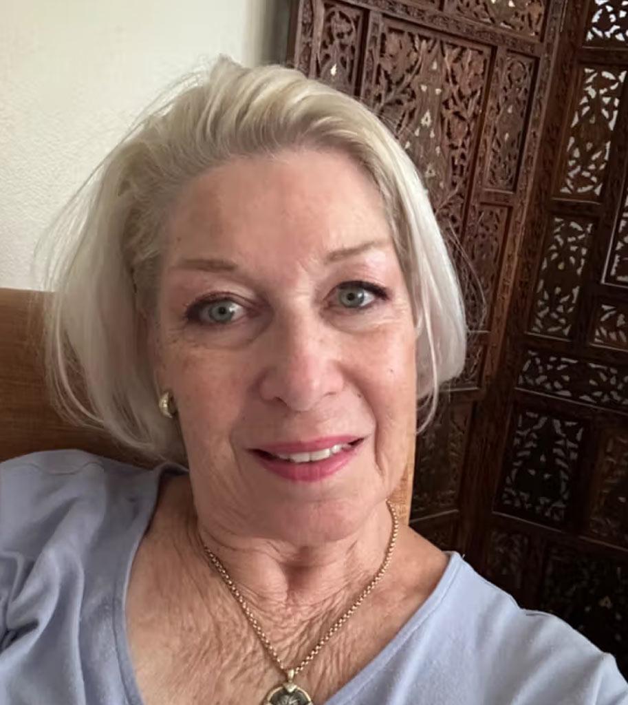 Before After - Review 1