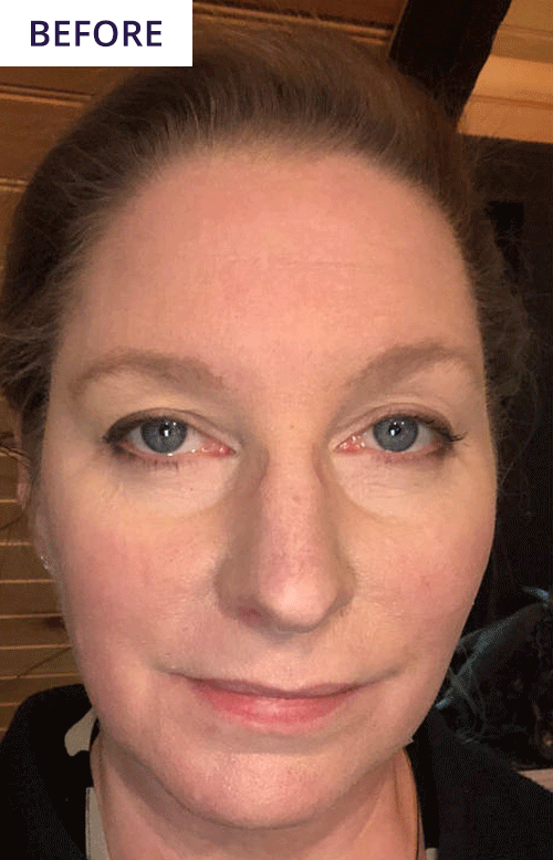 Before and After - Catherine Moulton