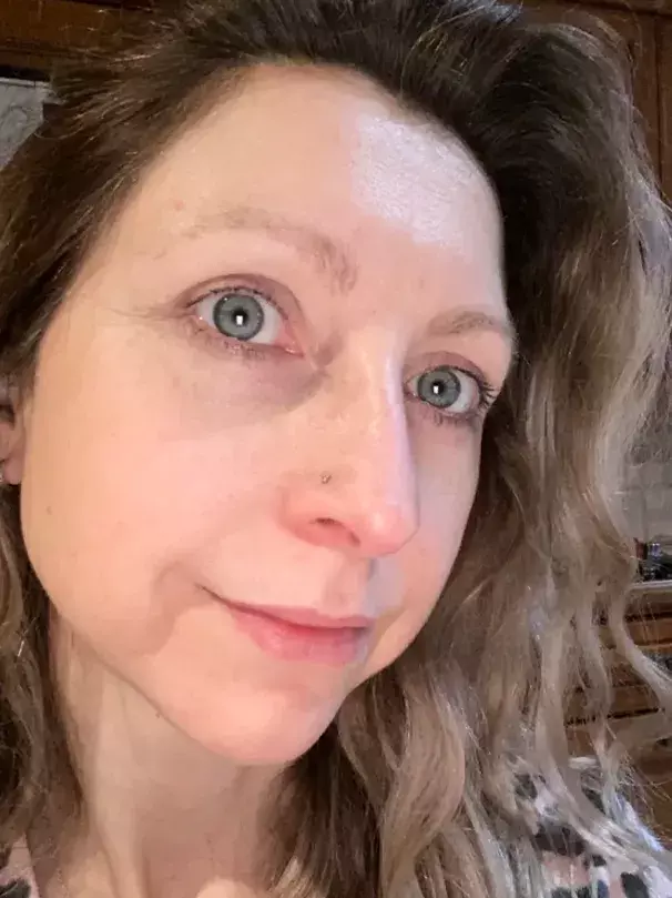 Before image of customer 2