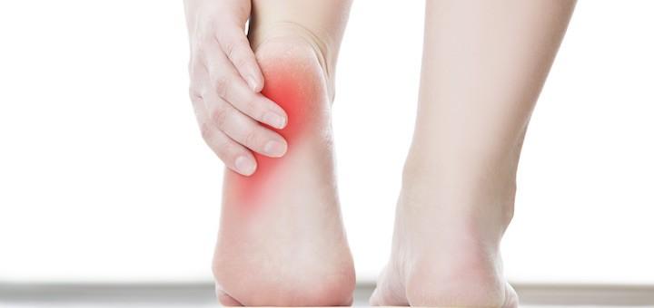 close-up of person's feet, looking at them from the back. They're reaching down to touch their heel that is red and inflamed.