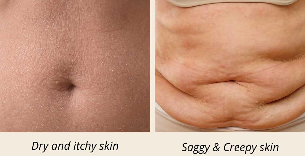 dry, itchy and creepy skin images